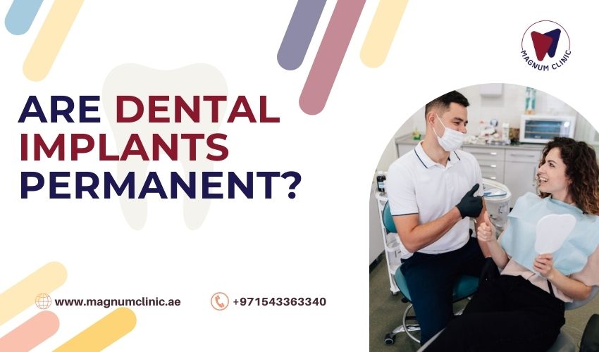 Are Dental Implants Permanent - Magnum Clinic Dubai