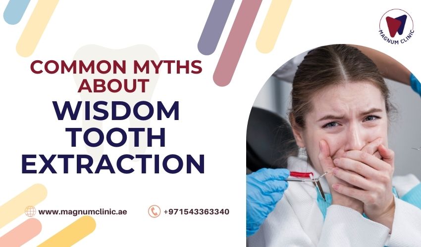 Common Myths About Wisdom Tooth Extraction