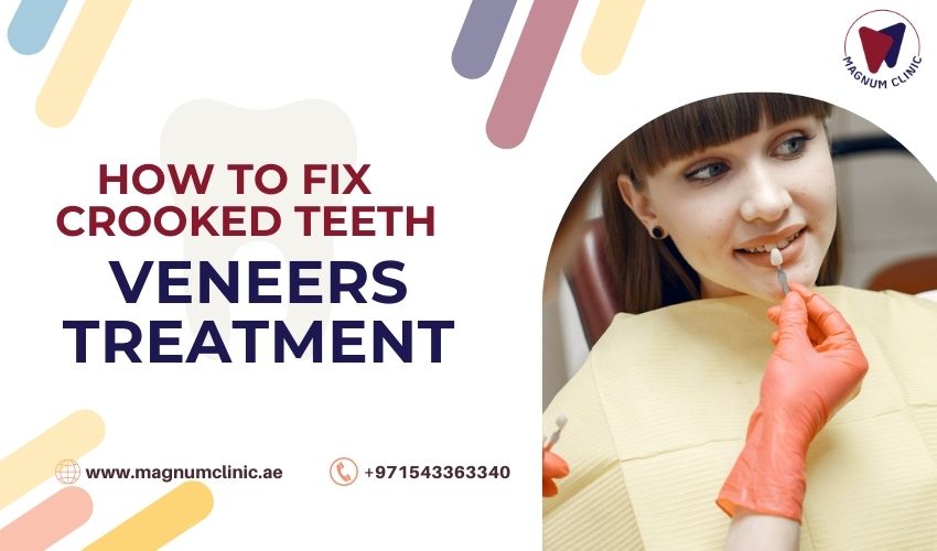 how to fix crooked teeth - Veneers Treatment