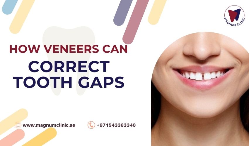 Correct Tooth Gaps and Irregularities - Magnum Clinic