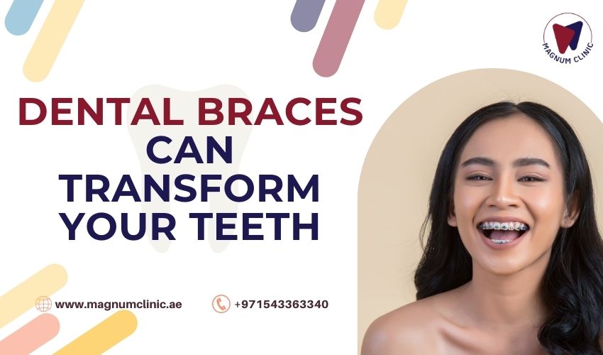 Dental Braces Can Transform Your Teeth