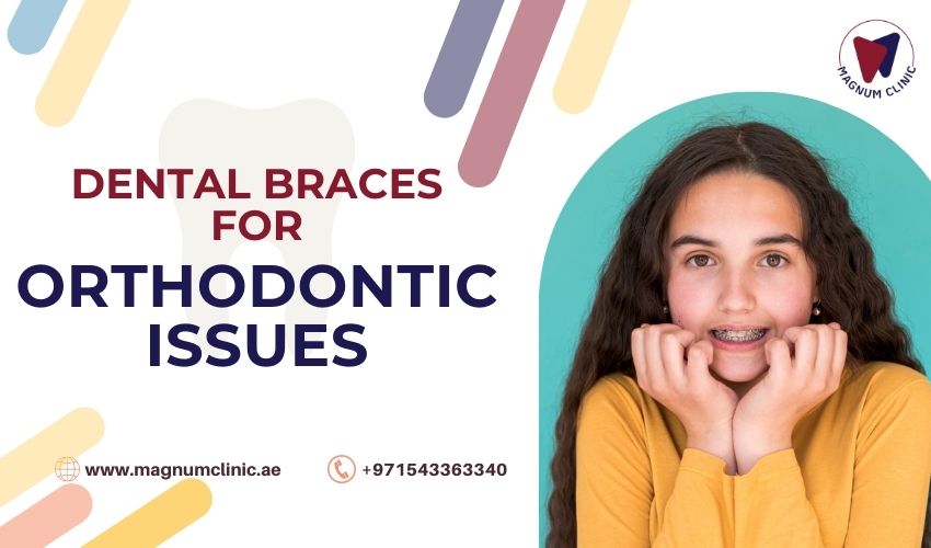 Dental Braces for Orthodontic Issues - Magnum Clinic