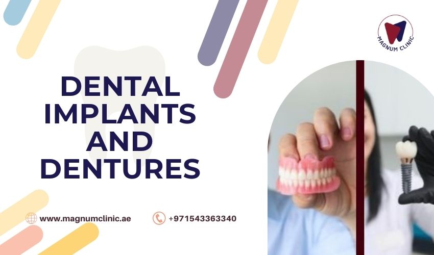 Dental Implants And Dentures - Magnum Clinic