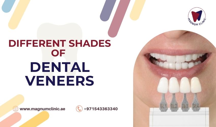 Dental Veneers Shades - Magnum Clinic
