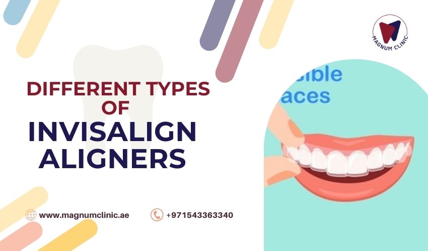 Different Types of Invisalign Aligners