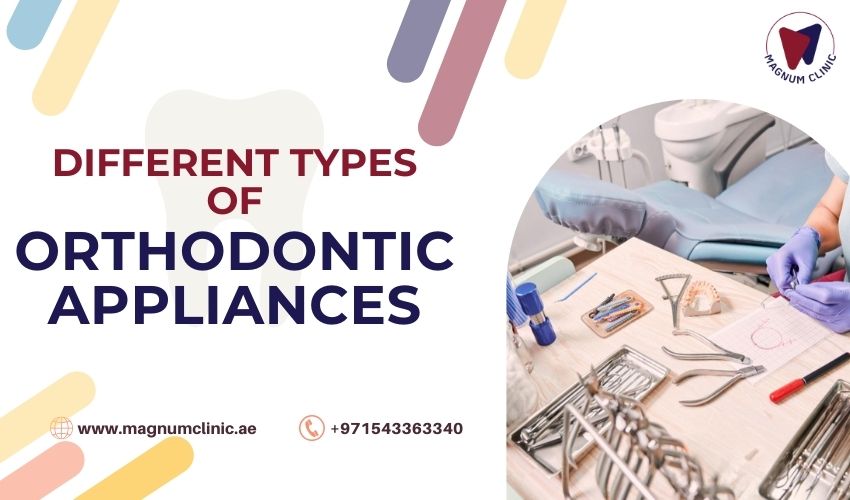 Different Types of Orthodontic Appliances