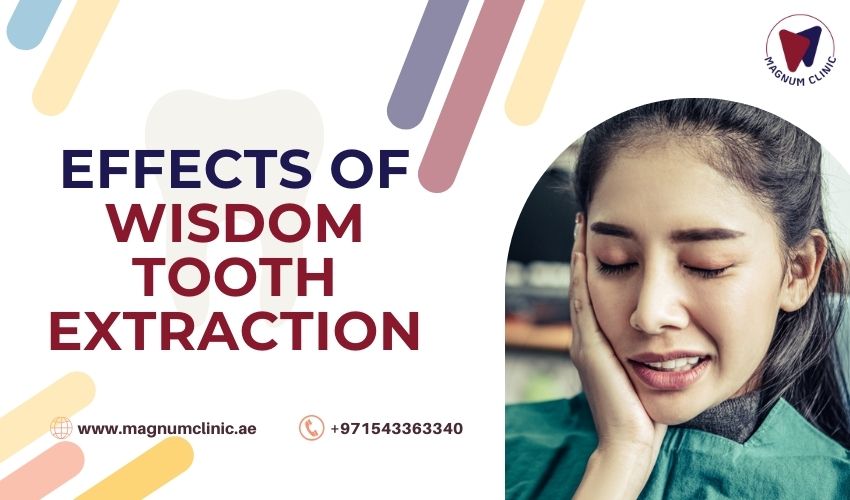 Effects of Wisdom Tooth Extraction - Magnum Clinic