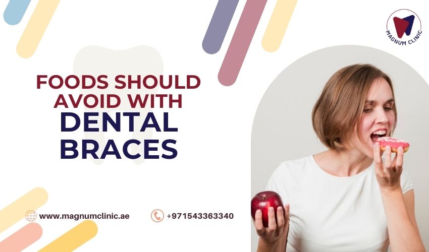 Foods Should Avoid With Dental Braces - Magnum Clinic Dubai