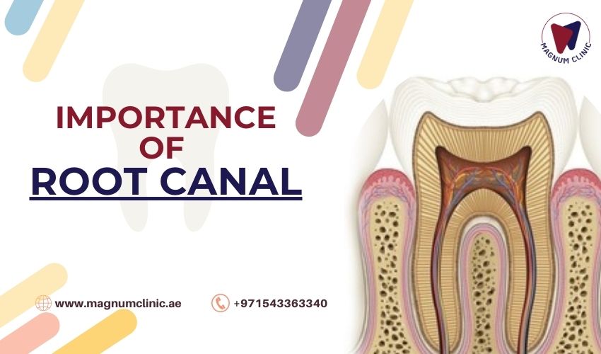Importance Of Root Canal - Magnum Clinic