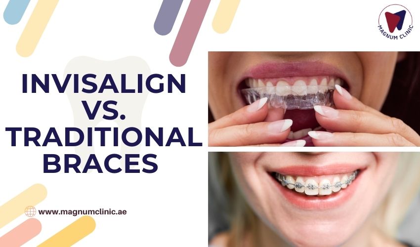 Invisalign vs Traditional Braces - Magnum Clinic