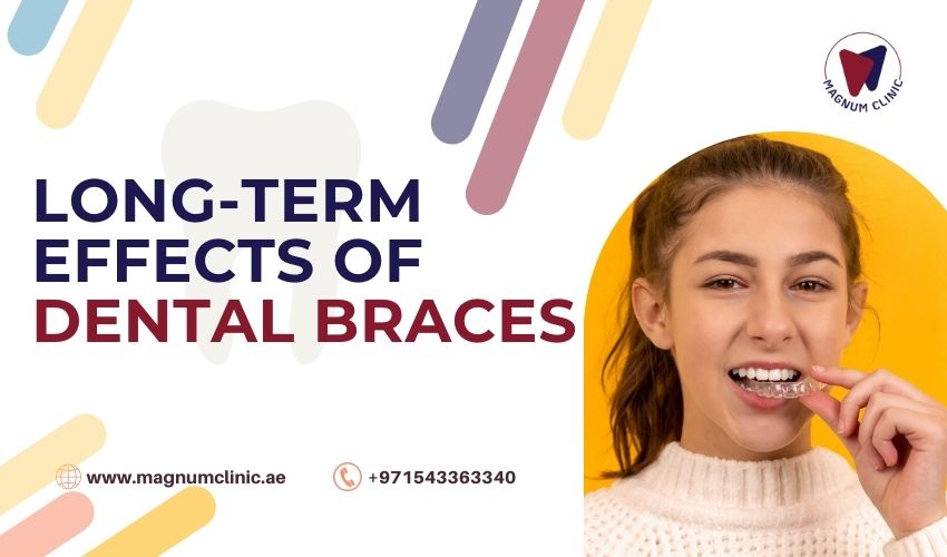 Long-Term Effects of Dental Braces