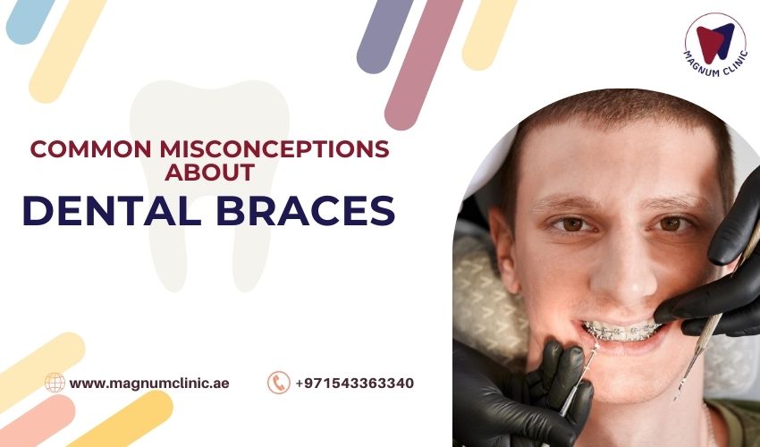 Misconceptions About Dental Braces - Magnum Clinic