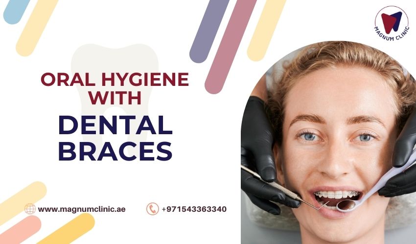Oral Hygiene with Dental Braces - Magnum Clinic