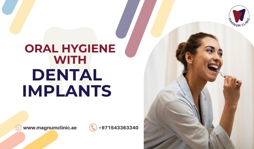 Oral Hygiene with Dental Implants - Magnum Clinic