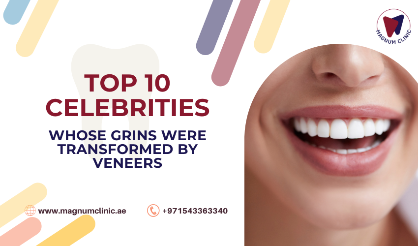 TOP 10 Celebrities Whose Grins Were Transformed by Veneers