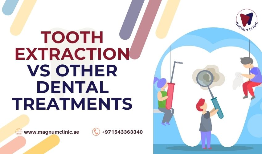 Tooth Extraction vs Other Dental Treatments