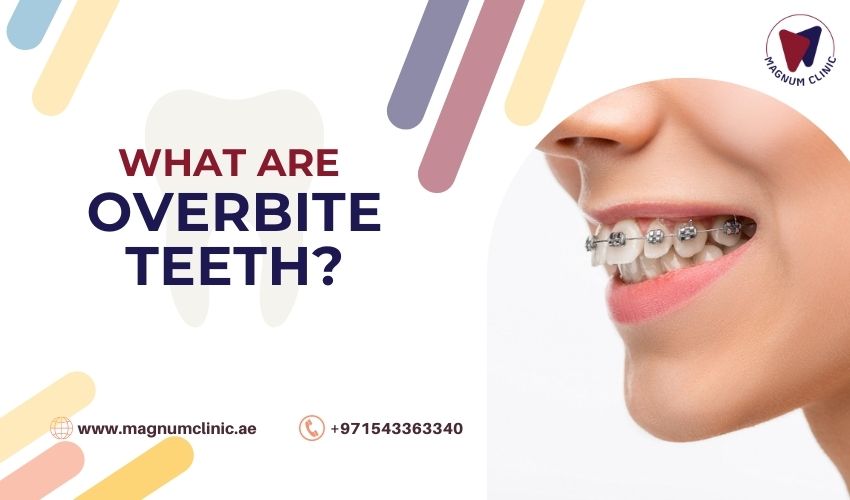 What Are Overbite Teeth, Symptoms, And How Is It Corrected?