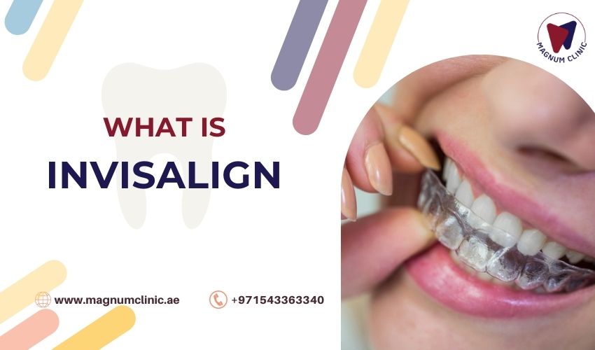 What Is Invisalign - Magnum Clinic Dubai