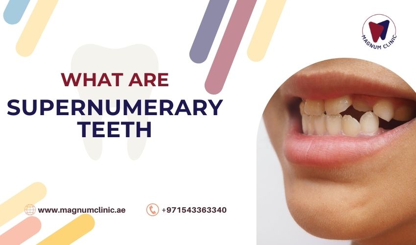 What are supernumerary teeth