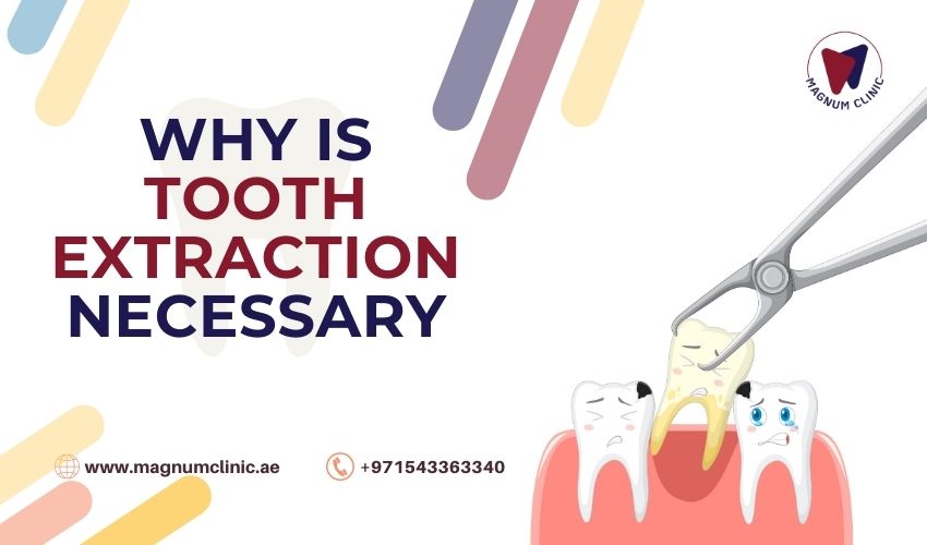 Why Is Tooth Extraction Necessary - Magnum Clinic